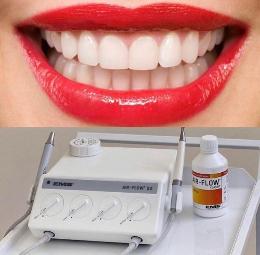 Профессиональная чистка зубов методом  Air Flow.