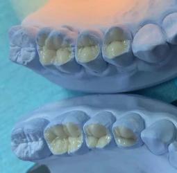 Зуботехническая лаборатория клиники «Алёна» - это место где делаются самые красивые и надежные зубки!